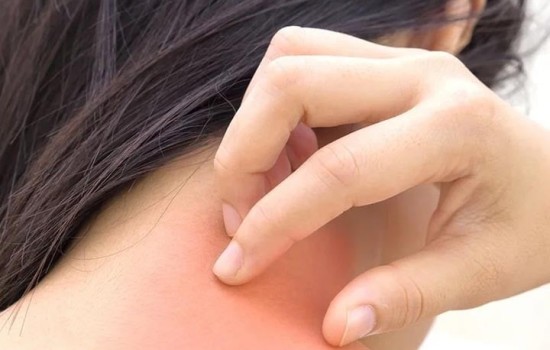 শীতে ত্বকে সংক্রমণ এড়াতে যা করবেন